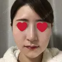 骨切り（あご） / 骨削り（エラ） / 骨削り（頬） / その他（輪郭） RG整形外科（旧リオン整形外科） DAY 12 サムネイル用
