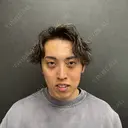 クマ治療 / ヒアルロン酸注入（目の下） / その他（目元） ネビュラクリニック 京都院 AFTER サムネイル用