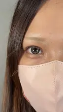 二重切開 / 目頭切開 / 上まぶたたるみ取り アリエル美容クリニック 大宮院 DAY 42 サムネイル用
