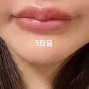 アートメイク（唇） / アートメイク（アイライン） Kinshicho Beauty Clinic （錦糸町ビューティークリニック） DAY 4 サムネイル用