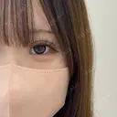 二重埋没 アリエル美容クリニック 大宮院 DAY 6 サムネイル用