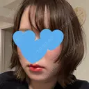 糸リフト / 脂肪吸引（顔） / ジョールファット除去 / 脂肪吸引注射（顔） SEA CLINIC（シークリニック） DAY 9 サムネイル用