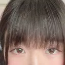 二重切開 / 眼瞼下垂（切開） 広島プルミエクリニック DAY 80 サムネイル用