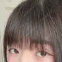 二重切開 / 眼瞼下垂（切開） 広島プルミエクリニック DAY 80 サムネイル用