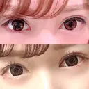 二重切開 郡山タウン形成外科クリニック AFTER サムネイル用