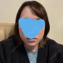 糸リフト / 脂肪吸引（顔） / ジョールファット除去 / 脂肪吸引注射（顔） SEA CLINIC（シークリニック） DAY 12 サムネイル用