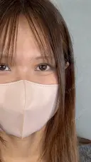 二重切開 / 目頭切開 / 上まぶたたるみ取り アリエル美容クリニック 大宮院 DAY 98 サムネイル用
