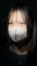 二重切開 / 目頭切開 / 上まぶたたるみ取り アリエル美容クリニック 大宮院 DAY 98 サムネイル用