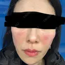 ジャルプロ ウィルビークリニック 新宿院 DAY 0 サムネイル用