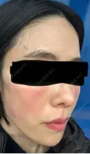 ジャルプロ ウィルビークリニック 新宿院 DAY 0 サムネイル用