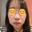 その他（輪郭） / イオン導入 ルラ美容クリニック 仙台院 / ルラスキンクリニック 仙台院 DAY 1 サムネイル用