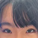 二重埋没 共立美容外科 大宮院 DAY 70 サムネイル用