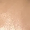 プラセンタ注射 新宿駅三丁目クリニック DAY 1 サムネイル用