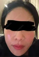 ジャルプロ ウィルビークリニック 新宿院 DAY 1 サムネイル用