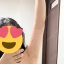 インディバ（二の腕） 渋谷美容外科クリニック 横浜院 DAY 2 サムネイル用