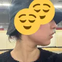 オンダリフト ルラ美容クリニック 名古屋本院 DAY 0 サムネイル用