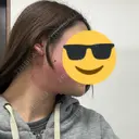 インモード 東京シルククリニック 新宿院 DAY 0 サムネイル用