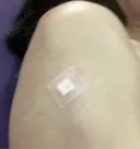 プラセンタ注射 新宿駅三丁目クリニック AFTER サムネイル用