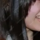 光治療（フォトフェイシャルなど） 城本クリニック 静岡院 DAY 1 サムネイル用