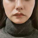 ボトックス（エラ・小顔） 新未来クリニック DAY 17 サムネイル用