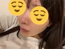 鼻中隔延長（切開） / その他（鼻） / 軟骨移植 / 鼻孔縁下降 / 鼻柱下降・鼻唇角形成（猫手術） KIHARU CLINIC DAY 74 サムネイル用