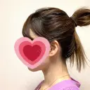 脂肪吸引（顔） R Beauty CLINIC 銀座院 DAY 17 サムネイル用