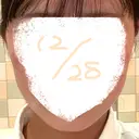 ボトックス（エラ・小顔） 東京美容皮膚科アロエクリニック池袋 DAY 1 サムネイル用