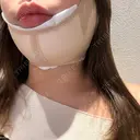 脂肪吸引（顔） HAAB BEAUTY CLINIC 南青山本院（新院） DAY 0 サムネイル用