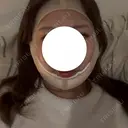脂肪吸引（顔） HAAB BEAUTY CLINIC 南青山本院（新院） DAY 0 サムネイル用