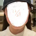 ボトックス（エラ・小顔） 東京美容皮膚科アロエクリニック池袋 AFTER サムネイル用