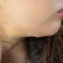 糸リフト / 脂肪吸引（顔） / 水光注射（ハリ・美肌） Wing clinic 豊中駅前院 DAY 7 サムネイル用