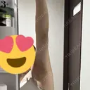 インディバ（二の腕） 渋谷美容外科クリニック 横浜院 AFTER サムネイル用