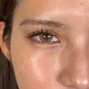 二重埋没 / 上まぶたの脂肪取り / 口角挙上 / ヒアルロン酸注入（涙袋） / ボトックス（エラ・小顔） / ヒアルロン酸注入（唇） / ボトックス（肩） アリエル美容クリニック 大宮院 DAY 7 サムネイル用