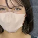 二重埋没 / 上まぶたの脂肪取り / 口角挙上 / ヒアルロン酸注入（涙袋） / ボトックス（エラ・小顔） / ヒアルロン酸注入（唇） / ボトックス（肩） アリエル美容クリニック 大宮院 DAY 7 サムネイル用