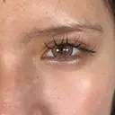 二重埋没 / 上まぶたの脂肪取り / 口角挙上 / ヒアルロン酸注入（涙袋） / ボトックス（エラ・小顔） / ヒアルロン酸注入（唇） / ボトックス（肩） アリエル美容クリニック 大宮院 DAY 44 サムネイル用