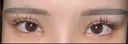 二重埋没 / 目頭切開 東京シンデレラ美容外科 池袋院 DAY 5 サムネイル用