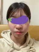 オンダリフト LIGHT CLINIC 【ライトクリニック】 名古屋院 DAY 0 サムネイル用