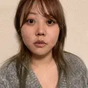 クマ治療 / 脂肪吸引（顔） 新宿美容外科ネビュラクリニック DAY 22 サムネイル用