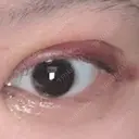 二重埋没 / 目頭切開 / 上まぶたの脂肪取り 9BeautyClinic AFTER サムネイル用