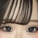 二重埋没 アリエル美容クリニック 大宮院 DAY 13 サムネイル用