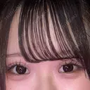 二重埋没 アリエル美容クリニック 大宮院 DAY 20 サムネイル用
