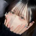 二重埋没 アリエル美容クリニック 大宮院 DAY 39 サムネイル用