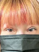 二重埋没 湘南美容クリニック 千葉センシティ院 DAY 1 サムネイル用