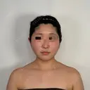 糸リフト / バッカルファット除去 / 脂肪吸引（顔） / ボトックス（あご） / ボトックス（エラ・小顔） アリエル美容クリニック 水戸院 DAY 14 サムネイル用