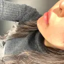 ボトックス（あご） / ヒアルロン酸注入（あご） / ヒアルロン酸注入（唇） HAAB×DREAM BEAUTY CLINIC 大阪梅田院 DAY 0 サムネイル用