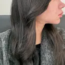 糸リフト / バッカルファット除去 / 脂肪吸引（顔） / メーラーファット除去 / ジョールファット除去 / 脂肪注入（輪郭） First Clinic DAY 106 サムネイル用