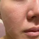 ヴェルヴェットスキン 形成外科と美容外科のクリニック池袋 AFTER サムネイル用