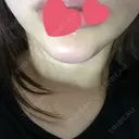 ボトックス（あご） / ヒアルロン酸注入（あご） HAAB BEAUTY CLINIC 名古屋院 DAY 1 サムネイル用