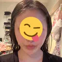 糸リフト A CLINIC（エークリニック） 大阪院 DAY 1 サムネイル用