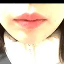 ボトックス（あご） / 肌ヒアルロン酸注入（たるみ・シワ改善） BIZENNクリニック【ビゼンクリニック】 AFTER サムネイル用